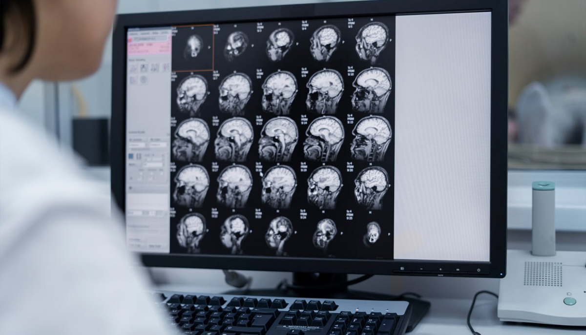 В России заработал первый в мире ИИ-сервис для комплексной оценки развития мозга новорождённых